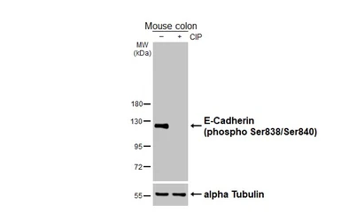 Anti-E-Cadherin (phospho Ser838/Ser840) antibody [HL3201] used in Western Blot (WB). GTX640841