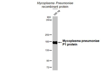 Anti-Mycoplasma pneumoniae P1 protein antibody [HL3203] used in Western Blot (WB). GTX640843