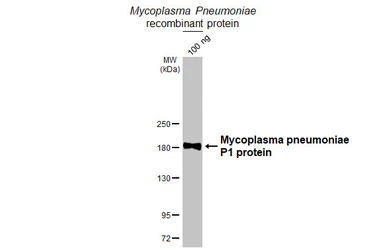 Anti-Mycoplasma pneumoniae P1 protein antibody [HL3204] used in Western Blot (WB). GTX640844