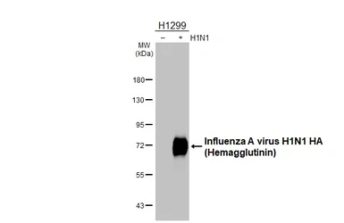 Anti-Influenza A virus H1N1 HA (Hemagglutinin) antibody [HL3261] used in Western Blot (WB). GTX640908