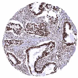 Anti-KAP1 antibody [HMV335] HistoMAX&trade; used in IHC (Paraffin sections) (IHC-P). GTX640915