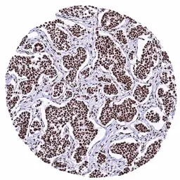 Anti-KAP1 antibody [HMV335] HistoMAX&trade; used in IHC (Paraffin sections) (IHC-P). GTX640915