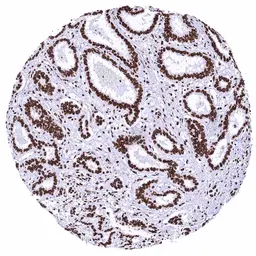 Anti-KAP1 antibody [HMV335] HistoMAX&trade; used in IHC (Paraffin sections) (IHC-P). GTX640915