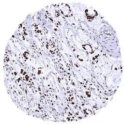 Anti-KAP1 antibody [HMV335] HistoMAX&trade; used in IHC (Paraffin sections) (IHC-P). GTX640915