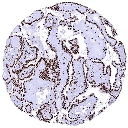 Anti-KAP1 antibody [HMV335] HistoMAX&trade; used in IHC (Paraffin sections) (IHC-P). GTX640915