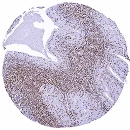 Anti-SMARCA2 antibody [HMV337] HistoMAX&trade; used in IHC (Paraffin sections) (IHC-P). GTX640917