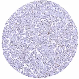 Anti-SMARCA2 antibody [HMV337] HistoMAX&trade; used in IHC (Paraffin sections) (IHC-P). GTX640917
