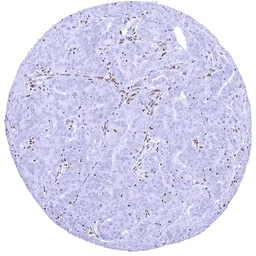 Anti-SMARCA2 antibody [HMV337] HistoMAX&trade; used in IHC (Paraffin sections) (IHC-P). GTX640917