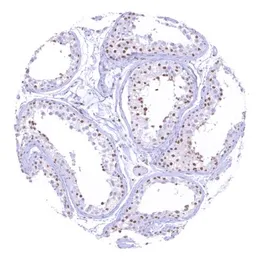 Anti-SMARCA2 antibody [HMV337] HistoMAX&trade; used in IHC (Paraffin sections) (IHC-P). GTX640917