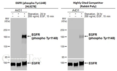 Anti-EGFR (phospho Tyr1148) antibody [HL3278] used in Western Blot (WB). GTX640932