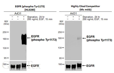 Anti-EGFR (phospho Tyr1173) antibody [HL3283] used in Western Blot (WB). GTX640937
