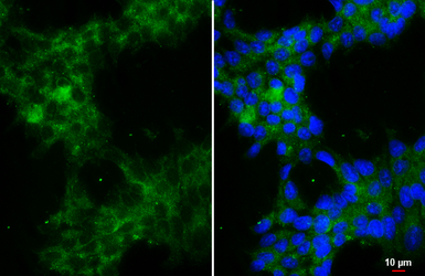 Anti-alpha 1a Adrenergic Receptor antibody [HL3291] used in Immunocytochemistry/ Immunofluorescence (ICC/IF). GTX640945