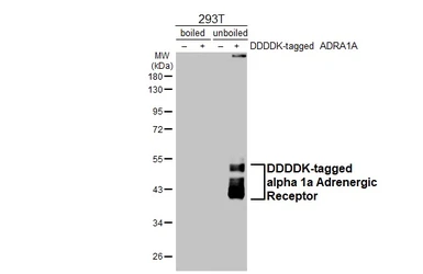 Anti-alpha 1a Adrenergic Receptor antibody [HL3291] used in Western Blot (WB). GTX640945