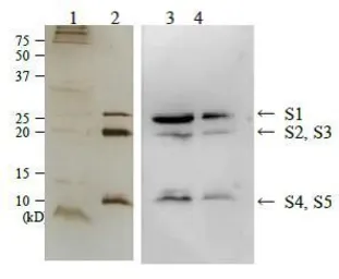 Anti-Bordetella pertussis Toxin antibody used in Western Blot (WB). GTX64098