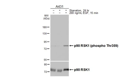 Anti-p90 RSK1 (phospho Thr359) antibody [HL3429] used in Western Blot (WB). GTX641271