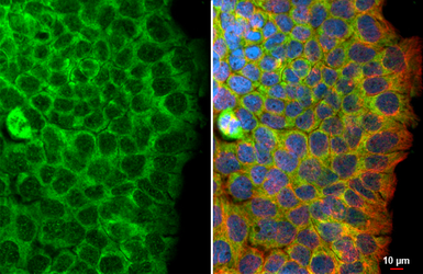 Anti-Flightless I antibody [HL3438] used in Immunocytochemistry/ Immunofluorescence (ICC/IF). GTX641311