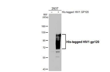 Anti-HIV1 gp120 antibody [GT45] used in Western Blot (WB). GTX641330