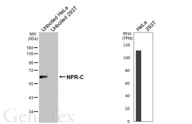 Anti-NPR-C antibody [HL3462] used in Western Blot (WB). GTX641347