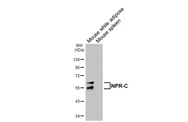 Anti-NPR-C antibody [HL3462] used in Western Blot (WB). GTX641347