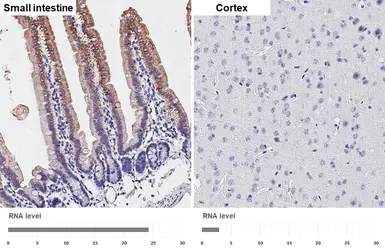Anti-HKDC1 antibody [HL3464] used in IHC (Paraffin sections) (IHC-P). GTX641349