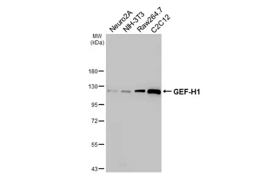 Anti-GEF-H1 antibody [HL3470] used in Western Blot (WB). GTX641355