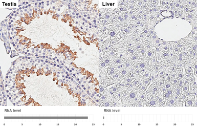 Anti-GEF-H1 antibody [HL3470] used in IHC (Paraffin sections) (IHC-P). GTX641355