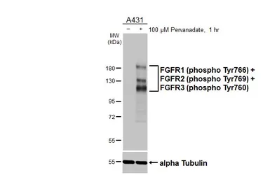 Anti-FGFR1 (phospho Tyr766) + FGFR2 (phospho Tyr769) + FGFR3 (phospho Tyr760) antibody [HL3487] used in Western Blot (WB). GTX641372