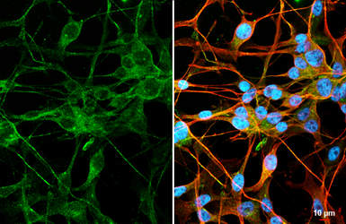 Anti-Autotaxin antibody [HL3488] used in Immunocytochemistry/ Immunofluorescence (ICC/IF). GTX641376