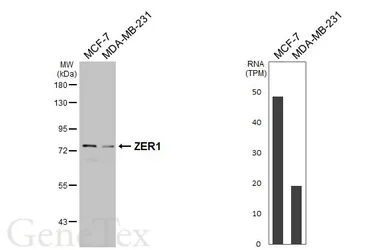 Anti-ZER1 antibody [HL3491] used in Western Blot (WB). GTX641379