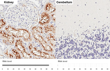 Anti-XPNPEP2 antibody [HL3492] used in IHC (Paraffin sections) (IHC-P). GTX641380