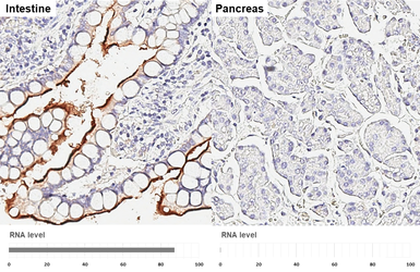 Anti-XPNPEP2 antibody [HL3492] used in IHC (Paraffin sections) (IHC-P). GTX641380