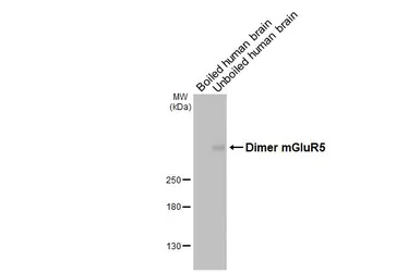 Anti-mGluR5 antibody [HL3509] used in Western Blot (WB). GTX641397