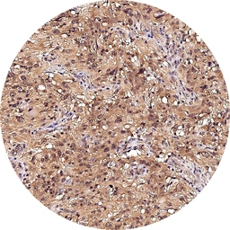 Anti-mGluR5 antibody [H339] HistoMAX&trade; used in IHC (Paraffin sections) (IHC-P). GTX641400