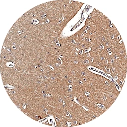 Anti-mGluR5 antibody [H339] HistoMAX&trade; used in IHC (Paraffin sections) (IHC-P). GTX641400