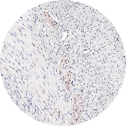 Anti-mGluR5 antibody [H339] HistoMAX&trade; used in IHC (Paraffin sections) (IHC-P). GTX641400