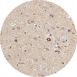 Anti-Somatostatin receptor 3 antibody [H340] HistoMAX&trade; used in IHC (Paraffin sections) (IHC-P). GTX641401