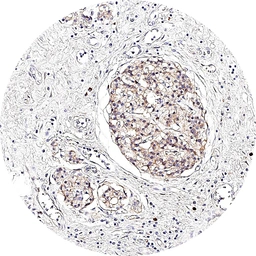 Anti-Somatostatin receptor 3 antibody [H340] HistoMAX&trade; used in IHC (Paraffin sections) (IHC-P). GTX641401