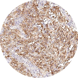 Anti-Somatostatin receptor 3 antibody [H340] HistoMAX&trade; used in IHC (Paraffin sections) (IHC-P). GTX641401