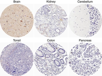 Anti-Somatostatin receptor 3 antibody [H340] HistoMAX&trade; used in IHC (Paraffin sections) (IHC-P). GTX641401