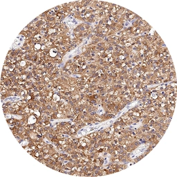 Anti-Adenosine A1 Receptor antibody [H341] HistoMAX&trade; used in IHC (Paraffin sections) (IHC-P). GTX641402