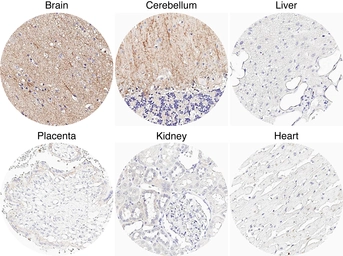 Anti-Adenosine A1 Receptor antibody [H341] HistoMAX&trade; used in IHC (Paraffin sections) (IHC-P). GTX641402