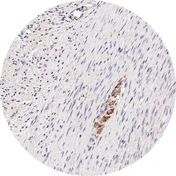 Anti-CXCR7 antibody [H342] HistoMAX&trade; used in IHC (Paraffin sections) (IHC-P). GTX641403