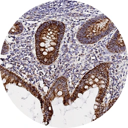 Anti-CXCR7 antibody [H342] HistoMAX&trade; used in IHC (Paraffin sections) (IHC-P). GTX641403