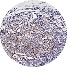 Anti-CXCR7 antibody [H342] HistoMAX&trade; used in IHC (Paraffin sections) (IHC-P). GTX641403