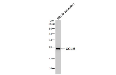Anti-GCLM antibody [HL3517] used in Western Blot (WB). GTX641414