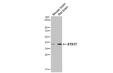 Anti-STX17 antibody [HL3534] used in Western Blot (WB). GTX641431