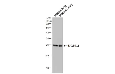 Anti-UCHL3 antibody [HL3564] used in Western Blot (WB). GTX641470