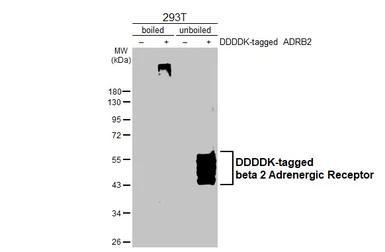 Anti-beta 2 Adrenergic Receptor antibody [HL3594] used in Western Blot (WB). GTX641565