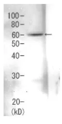 Anti-Rpn3 (S. cerevisiae) antibody used in Western Blot (WB). GTX64158