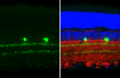 Anti-Choline Acetyltransferase antibody [HL3617] used in IHC (Paraffin sections) (IHC-P). GTX641592